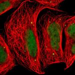 FAM98B Polyclonal Antibody