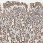 FHDC1 Antibody in Immunohistochemistry (Paraffin) (IHC (P))