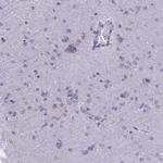 TMEM206 Antibody in Immunohistochemistry (Paraffin) (IHC (P))