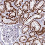 TMEM206 Antibody in Immunohistochemistry (Paraffin) (IHC (P))