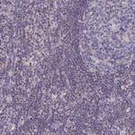 TMEM206 Antibody in Immunohistochemistry (Paraffin) (IHC (P))