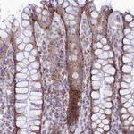 TMEM206 Antibody in Immunohistochemistry (Paraffin) (IHC (P))