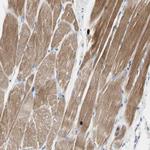 ECRG4 Antibody in Immunohistochemistry (Paraffin) (IHC (P))