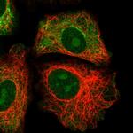 GRAMD1B Polyclonal Antibody