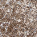 GRAMD1B Antibody in Immunohistochemistry (Paraffin) (IHC (P))
