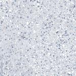 SLC22A2 Antibody in Immunohistochemistry (Paraffin) (IHC (P))