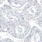 SLC22A2 Antibody in Immunohistochemistry (Paraffin) (IHC (P))