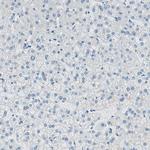 SLC22A2 Antibody in Immunohistochemistry (IHC)