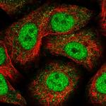 Nope Polyclonal Antibody