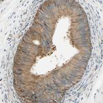 Nope Antibody in Immunohistochemistry (IHC)