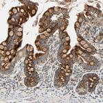 MRPL9 Antibody in Immunohistochemistry (Paraffin) (IHC (P))