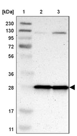 MRPL9 Antibody in Western Blot (WB)