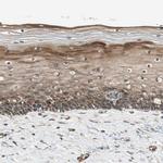 PFDN5 Antibody in Immunohistochemistry (Paraffin) (IHC (P))