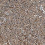 PFDN5 Polyclonal Antibody