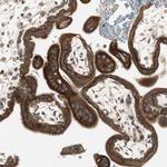 PFDN5 Antibody in Immunohistochemistry (Paraffin) (IHC (P))