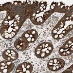 PFDN5 Antibody in Immunohistochemistry (Paraffin) (IHC (P))