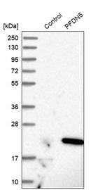 PFDN5 Antibody in Western Blot (WB)