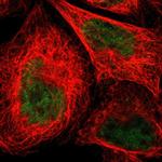 NMI Polyclonal Antibody