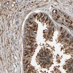 CSMD2 Polyclonal Antibody