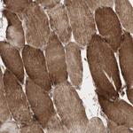 AKAP1 Antibody in Immunohistochemistry (Paraffin) (IHC (P))