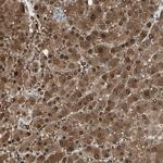 EVC Polyclonal Antibody