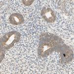 MRVI1 Antibody in Immunohistochemistry (Paraffin) (IHC (P))