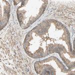 MRVI1 Antibody in Immunohistochemistry (Paraffin) (IHC (P))