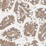 MRVI1 Antibody in Immunohistochemistry (Paraffin) (IHC (P))