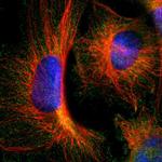 RNF14 Polyclonal Antibody