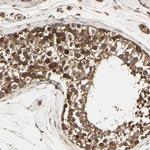 RNF14 Antibody in Immunohistochemistry (Paraffin) (IHC (P))