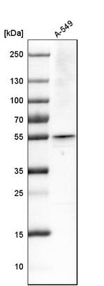 RNF14 Antibody in Western Blot (WB)