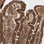 ANKHD1 Antibody in Immunohistochemistry (Paraffin) (IHC (P))