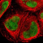 FOXJ2 Polyclonal Antibody