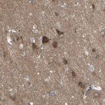 PCDHGA2 Polyclonal Antibody