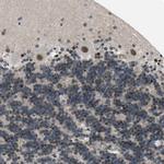 THAP12 Antibody in Immunohistochemistry (Paraffin) (IHC (P))