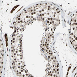 THAP12 Antibody in Immunohistochemistry (Paraffin) (IHC (P))