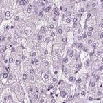 Chromogranin B Antibody in Immunohistochemistry (IHC)