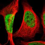 SRSF11 Polyclonal Antibody
