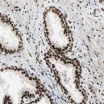SRSF11 Antibody in Immunohistochemistry (IHC)