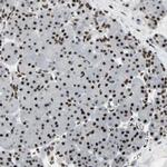 SRSF11 Antibody in Immunohistochemistry (IHC)