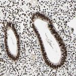 SRSF11 Antibody in Immunohistochemistry (IHC)