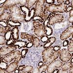 Carbonic Anhydrase XII Antibody in Immunohistochemistry (Paraffin) (IHC (P))