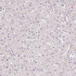 v-Myb Antibody in Immunohistochemistry (Paraffin) (IHC (P))