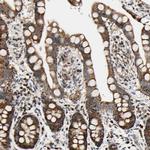 KIAA0907 Antibody in Immunohistochemistry (Paraffin) (IHC (P))