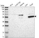 KIAA0907 Antibody in Western Blot (WB)