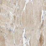 UXS1 Antibody in Immunohistochemistry (IHC)