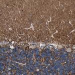 Neurofascin Antibody in Immunohistochemistry (IHC)