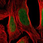 TSHZ3 Polyclonal Antibody