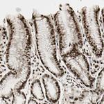 TSHZ3 Antibody in Immunohistochemistry (Paraffin) (IHC (P))