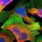 GRAMD1A Polyclonal Antibody